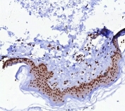 IHC staining of FFPE human skin tissue with PCNA antibody (clone PCNA/8633R). HIER: boil tissue sections in pH 9 10mM Tris with 1mM EDTA for 20 min and allow to cool before testing.