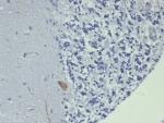 IHC staining of FFPE human brain tissue with GIRK2 antibody (clone KCNJ6/7559) at 2ug/ml. HIER: boil tissue sections in pH 9 10mM Tris with 1mM EDTA for 20 min and allow to cool before testing.
