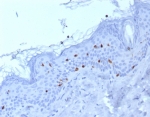 IHC staining of FFPE human skin tissue with Langerin antibody (clone LGRN/7430). HIER: boil tissue sections in pH 9 10mM Tris with 1mM EDTA for 20 min and allow to cool before testing.