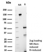 SDS-PAGE analysis of purified, BSA-free FABP3 antibody (clone FABP3/8440) as confirmation of integrity and purity.