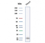 Western blot testing of human heart lysate with FABP3 antibody. Predicted molecular weight ~14 kDa.