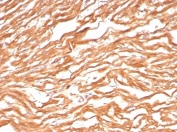 IHC staining of FFPE human heart tissue with FABP3 antibody (clone FABP3/8443). HIER: boil tissue sections in pH 9 10mM Tris with 1mM EDTA for 20 min and allow to cool before testing.