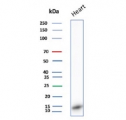 Western blot testing of human heart tissue lysate with FABP3 antibody. Predicted molecular weight ~14 kDa.