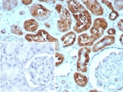 IHC staining of FFPE human heart tissue with H-FABP antibody (clone rFABP3/8534). HIER: boil tissue sections in pH 9 10mM Tris with 1mM EDTA for 20 min and allow to cool before testing.
