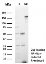 SDS-PAGE analysis of purified, BSA-free H-FABP antibody (clone rFABP3/8534) as confirmation of integrity and purity.