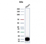 Western blot testing of different lots of human heart lysate with H-FABP antibody. Predicted molecular weight ~14 kDa.