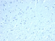 Negative control: IHC testing of FFPE human brain tissue with INHA antibody (clone INHA/8872R) at 2ug/ml. HIER: boil tissue sections in pH 9 10mM Tris with 1mM EDTA for 20 min and allow to cool before testing.