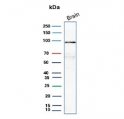 Western blot testing of human brain tissue lysate with Beta Catenin antibody (clone CTNNB1/8280R). Predicted molecular weight ~85 kDa, but routinely observed at 90-95 kDa.