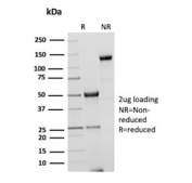 SDS-PAGE analysis of purified, BSA-free CSTA antibody (clone rCSTA/8995) as confirmation of integrity and purity.