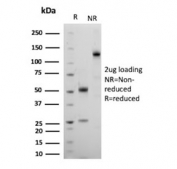 SDS-PAGE analysis of purified, BSA-free CD10 antibody (clone MME/8376R) as confirmation of integrity and purity.