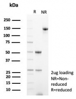 SDS-PAGE analysis of purified, BSA-free Transferrin antibody (clone TF/4795) as confirmation of integrity and purity.