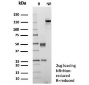 SDS-PAGE analysis of purified, BSA-free CD10 antibody (clone MME/8658R) as confirmation of integrity and purity.