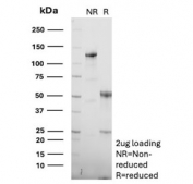 SDS-PAGE analysis of purified, BSA-free CD38 antibody (clone CD38/8335R) as confirmation of integrity and purity.