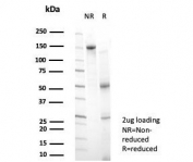 SDS-PAGE analysis of purified, BSA-free BCL6 antibody (clone PCRP-BCL6-1B1) as confirmation of integrity and purity.