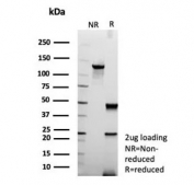 SDS-PAGE analysis of purified, BSA-free UchL1 antibody (clone rUCHL1/8133) as confirmation of integrity and purity.