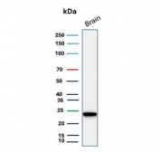 Western blot testing of human brain tissue lysate with UchL1 antibody. Predicted molecular weight ~25 kDa.