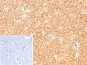 IHC staining of FFPE human cerebellum tissue with PGP9.5 antibody (clone UCHL1/8107R). Inset: PBS used in place of primary Ab (secondary Ab negative control). HIER: boil tissue sections in pH 9 10mM Tris with 1mM EDTA for 20 min and allow to cool before testing.