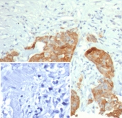 IHC staining of FFPE human bladder tissue with S100P antibody (clone S100P/7978R). Inset: PBS used in place of primary Ab (secondary Ab negative control). HIER: boil tissue sections in pH 9 10mM Tris with 1mM EDTA for 20 min and allow to cool before testing.