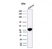Western blot testing of human kidney tissue lysate with AMACR antibody (clone AMACR/8350R). Predicted molecular weight ~43 kDa.