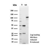 SDS-PAGE analysis of purified, BSA-free OCLN antibody (clone rOCLN/8776) as confirmation of integrity and purity.