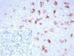 IHC staining of FFPE human tonsil tissue with SPARC antibody (clone OSTN/8528R). Inset: PBS used in place of primary Ab (secondary Ab negative control). HIER: boil tissue sections in pH 9 10mM Tris with 1mM EDTA for 20 min and allow to cool before testing.