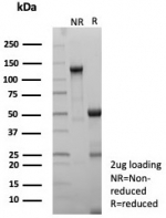 SDS-PAGE analysis of purified, BSA-free HLA-DP/DQ/DR (HLA-Pan/8622R) as confirmation of integrity and purity.