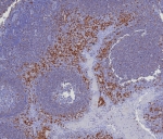 IHC staining of FFPE human tonsil tissue with IRF4 antibody (clone MUM1/8274R). HIER: boil tissue sections in pH 9 10mM Tris with 1mM EDTA for 20 min and allow to cool before testing.