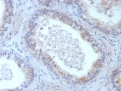 IHC staining of FFPE human epididymis tissue with ROS1 antibody (clone ROS1/8268R). HIER: boil tissue sections in pH 9 10mM Tris with 1mM EDTA for 20 min and allow to cool before testing.