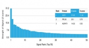 Analysis of a HuProt(TM) microarray containing more than 19,000 full-length human proteins using ER alpha antibody (clone AER311). Z- and S- Score: The Z-score represents the strength of a signal that a monoclonal antibody (in combination with a fluorescently-tagged anti-IgG secondary antibody) produces when binding to a particular protein on the HuProt(TM) array. Z-scores are described in units of standard deviations (SD's) above the mean value of all signals generated on that array. If targets on HuProt(TM) are arranged in descending order of the Z-score, the S-score is the difference (also in units of SD's) between the Z-score. S-score therefore represents the relative target specificity of a mAb to its intended target. A mAb is considered to specific to its intended target, if the mAb has an S-score of at least 2.5. For example, if a mAb binds to protein X with a Z-score of 43 and to protein Y with a Z-score of 14, then the S-score for the binding of that mAb to protein X is equal to 29.