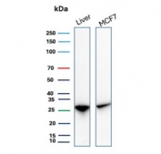 Western blot testing of human liver and MCF7 cell lysate with HSP27 / HSPB1 antibody (clone rHSPB1/7298). Predicted molecular weight: 23-27 kDa.