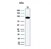 Western blot testing of human small intestine tissue lysate with Cadherin 17 antibody. Predicted molecular weight ~92 kDa but may be observed at higher molecular weights due to glycosylation.