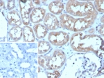 IHC staining of FFPE human kidney tissue with ADCY8 antibody (clone ADCY8/7573). Inset: PBS used in place of primary Ab (secondary Ab negative control). HIER: boil tissue sections in pH 9 10mM Tris with 1mM EDTA for 20 min and allow to cool before testing.