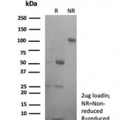 SDS-PAGE analysis of purified, BSA-free CA8 antibody (clone rCA8/8835) as confirmation of integrity and purity.