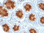 IHC staining of FFPE human colon tissue with NTRK2 antibody (clone NTRK2/4672). HIER: boil tissue sections in pH 9 10mM Tris with 1mM EDTA for 20 min and allow to cool before testing.