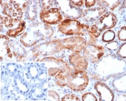 IHC staining of FFPE human kidney tissue with Carbonic Anhydrase IX antibody (clone CA9/4019). Inset: PBS used in place of primary Ab (secondary Ab negative control). HIER: boil tissue sections in pH 9 10mM Tris with 1mM EDTA for 20 min and allow to cool before testing.