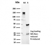 SDS-PAGE analysis of purified, BSA-free Carbonic Anhydrase IX antibody (clone CA9/4019) as confirmation of integrity and purity.