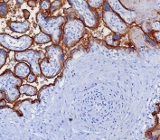 IHC staining of FFPE human placental tissue with Programmed cell death 1 ligand 1 antibody (clone PDL1/7568R). HIER: boil tissue sections in pH 9 10mM Tris with 1mM EDTA for 20 min and allow to cool before testing.
