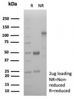 SDS-PAGE analysis of purified, BSA-free Pappalysin-1 antibody (clone PAPPA/8804R) as confirmation of integrity and purity.