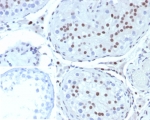 IHC staining of FFPE human testis tissue with Steroidogenic Factor 1 antibody (clone SF1/8000R). Inset: PBS used in place of primary Ab (secondary Ab negative control). HIER: boil tissue sections in pH 9 10mM Tris with 1mM EDTA for 20 min and allow to cool before testing.