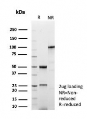 SDS-PAGE analysis of purified, BSA-free Dystrophin antibody (clone DMD/8773R) as confirmation of integrity and purity.