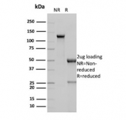SDS-PAGE analysis of purified, BSA-free GPC3 antibody (clone GPC3/8148R) as confirmation of integrity and purity.