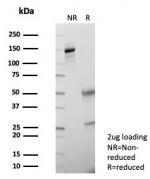 SDS-PAGE analysis of purified, BSA-free Glypican-3 antibody (clone GPC3/7419) as confirmation of integrity and purity.