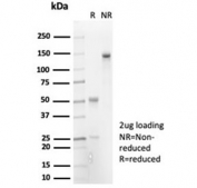 SDS-PAGE analysis of purified, BSA-free recombinant IL-7 antibody (clone IL7/7053R) as confirmation of integrity and purity.
