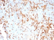 IHC staining of FFPE human adrenal gland tissue with IL-2 antibody (clone IL2/9007). HIER: boil tissue sections in pH 9 10mM Tris with 1mM EDTA for 20 min and allow to cool before testing.