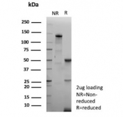 SDS-PAGE analysis of purified, BSA-free recombinant EBV antibody (clone EBV/9620R) as confirmation of integrity and purity.