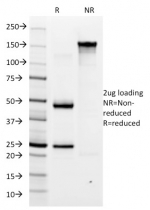 SDS-PAGE analysis of purified, BSA-free H. pylori antibody (clone HP/1335) as confirmation of integrity and purity.