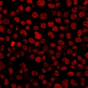 No staining was observed: Immunofluorescent staining of PFA-fixed human Raji cells with mouse IgG1 antibody (clone ICG1/ 1331, green) and Reddot nuclear stain (red).
