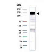 Western blot testing of human A431 cell lysate with recombinant Epidermal growth factor receptor antibody (clone EGFR/9166R). Expected molecular weight: 134-180 kDa depending on glycosylation level.