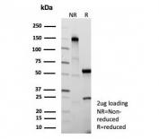 SDS-PAGE analysis of purified, BSA-free recombinant Cystatin A antibody (clone CSTA/9087R) as confirmation of integrity and purity.