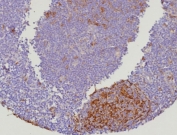 IHC staining of FFPE human lymph node tissue with recombinant Cystatin A antibody (clone CSTA/9087R). HIER: boil tissue sections in pH 9 10mM Tris with 1mM EDTA for 20 min and allow to cool before testing.